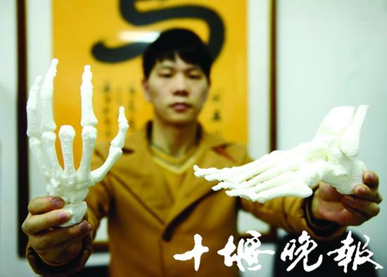 十堰尝鲜3D打印术 医院用它打印骨头模型