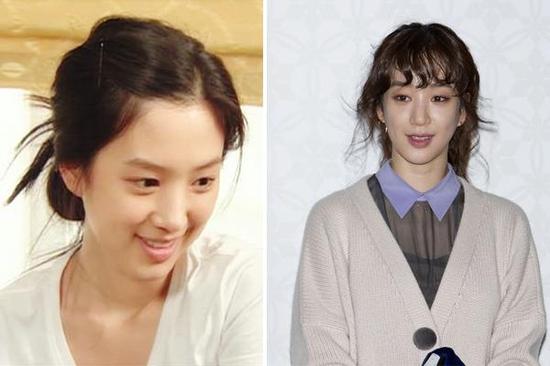 郑丽媛整容失败成僵尸脸