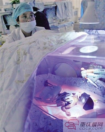 11月17日,正西北防治所男科监养护室,23周的早产男“筷儿子珍珍”在保温箱里接受治水疗。 (材料图片)重庆早报记者 雷键 摄