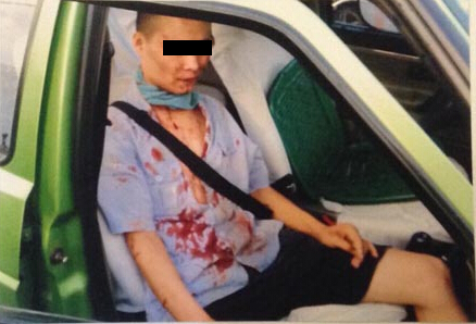 李斌当天被两名男乘客殴打20分钟后,满脸满身都是血。李斌律师提供