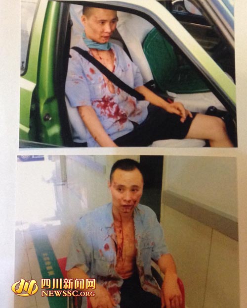 成都的哥被打得满脸是血