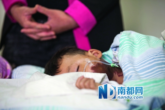 小哲误服浓硫酸,脸部、食道被烧伤,仍在留院观察。南都记者黎湛均 实习生钟振彬 摄