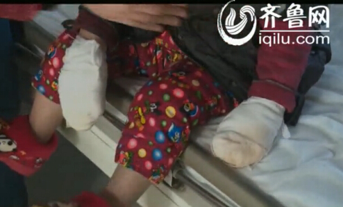 父親將2歲兒子雙手按進(jìn)滾水