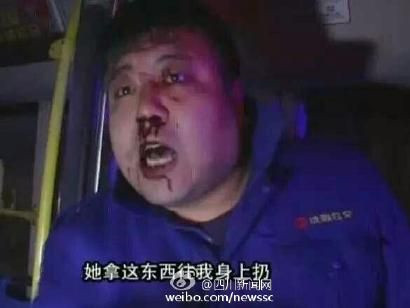 被打公交司机满脸血迹。