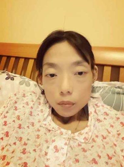 郭永淳前妻体重跌至40多斤