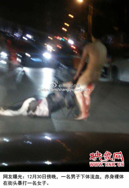 男子下體流血當街暴打一名女子