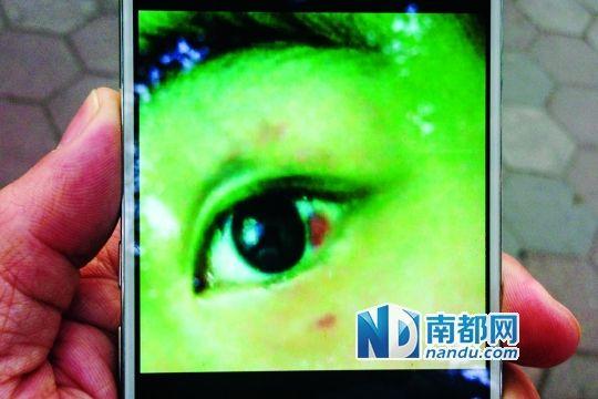 广州16岁女生遭室友殴打欲跳楼 曾遭多次辱骂