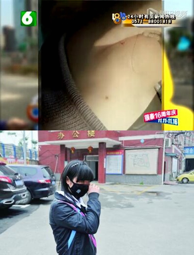 16岁女生遭15名女同学围殴 被打致鼓膜穿孔