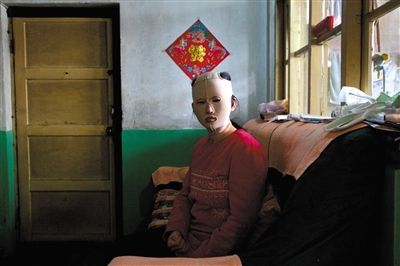 靳魏坤坐在家中，戴着修复面罩。除了去外地，她基本不出门。
