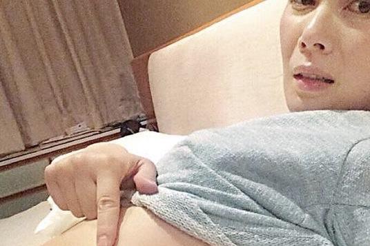 女星江希文疑遭律师丈夫家暴 腰大片瘀伤