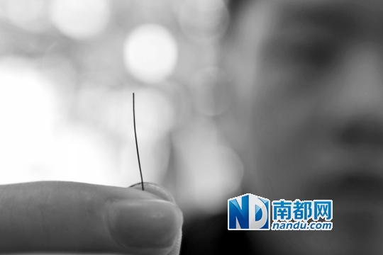 饶先生拿着从喉咙取出的约2 .5厘米长的铁丝。南都记者 黎湛均 摄