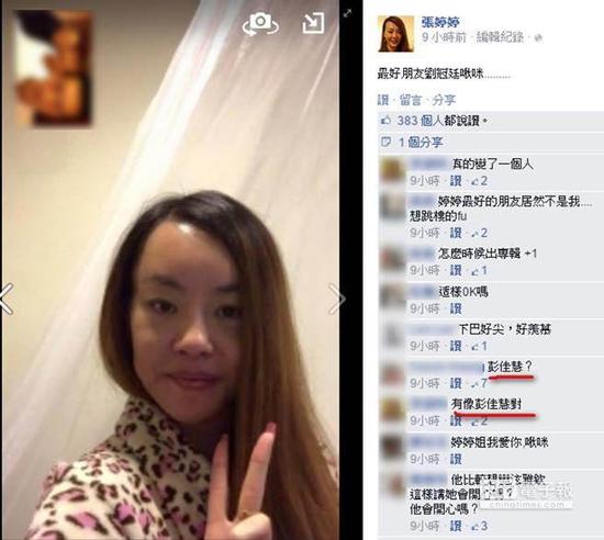 张婷婷术后公开照片