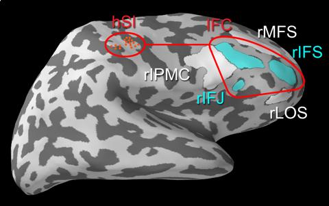 为了研究大脑如何有意忽略可感知激励，科学家分析了一种脑电波，它用来连接躯体感觉皮质区和右侧下额叶皮质。白色区域在实验中都受到了控制。图片由布朗大学提供。