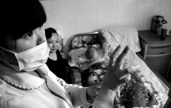 西安3天时间5名儿童因吞枣核被送医