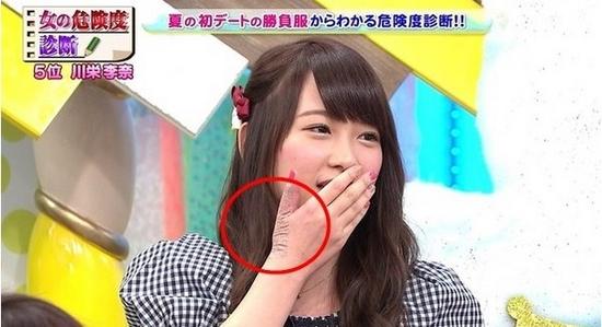 川荣李奈手上的伤疤清晰可见。