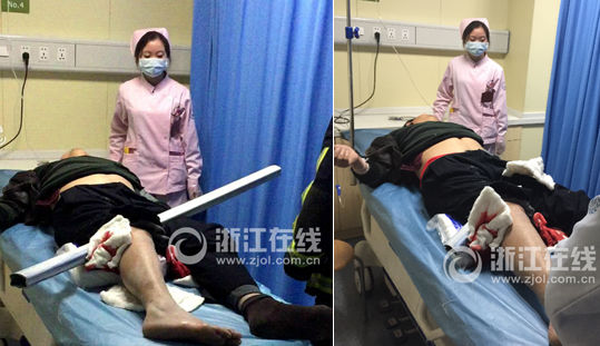 钢管外露部分太长,被切断后才能进行手术。