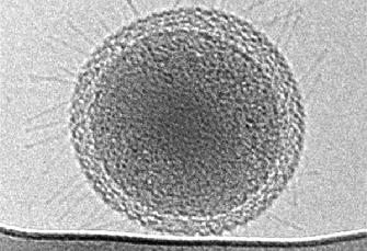 最小细菌体积仅为0.009平方微米