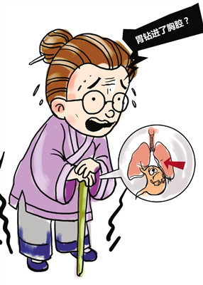 88岁老人恶心呕吐十多天 原是胃从腹部钻进胸