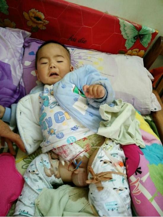 平顶山婴儿患重病 妈妈不忍孩子受罪想安乐死