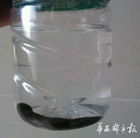 蚂蝗“蜗居”男孩喉咙