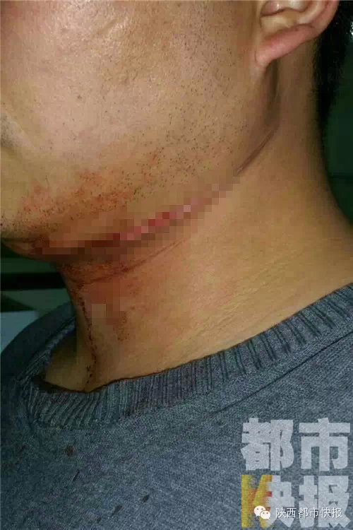 西安一摩的司機(jī)暴力抗法 不聽勸告竟持刀刺民警