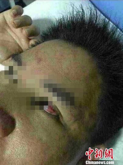 被打的一名医生目前仍在住院治疗。图片来自网络