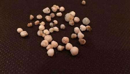 女子吃牡蛎吃出50颗珍珠惊呆餐厅经理(组图)