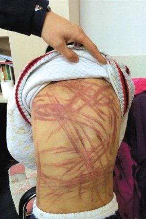 4月3日晚，微博网友“@朝廷半日闲”发图文微博展示男童被虐待的惨状。微博截图