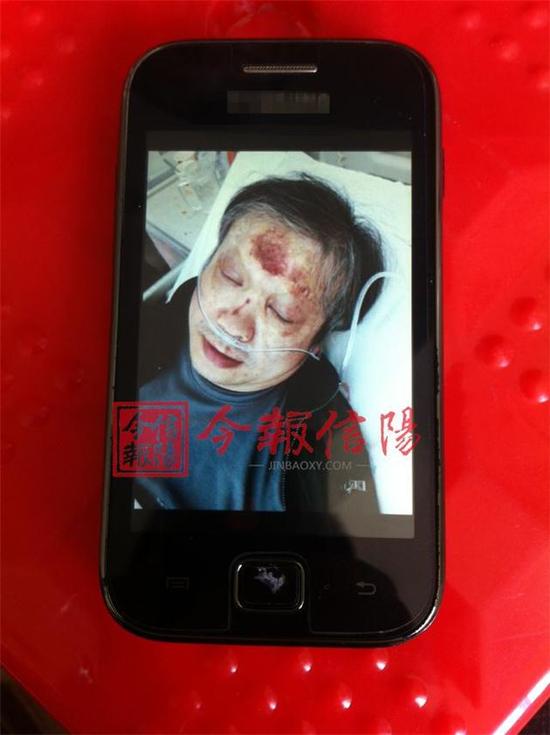 燕先生手機里保存的住院照片