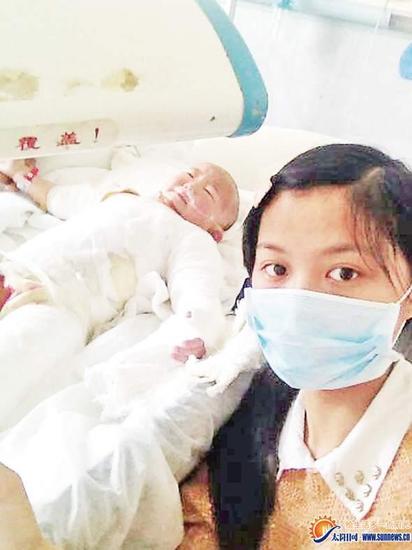 4岁可爱女孩跌入滚烫锅中 全身烫伤面积达64%