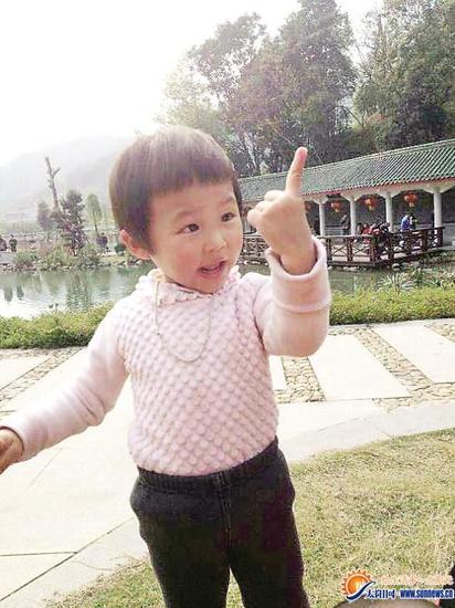 4岁可爱女孩跌入滚烫锅中 全身烫伤面积达64%