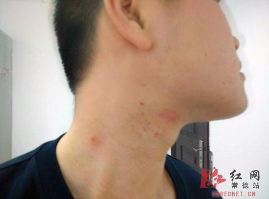 常德高速现黑压压蜜蜂群 四处乱飞蜇伤民警