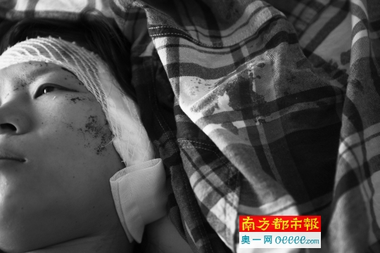 4月29日,北大医院内,王女士躺在病床上,左耳被砍重伤。南都记者 霍健斌 摄