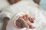 男子火场逃生手脚烧焦露骨 欲锯腿不给幼女留负担