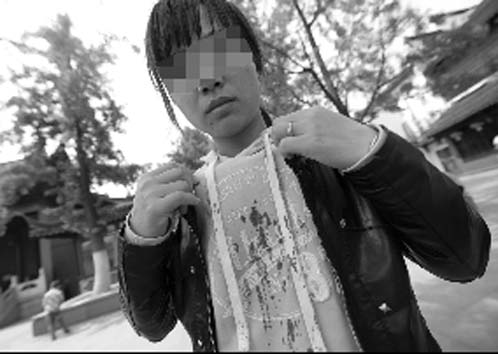 卖花女向记者展示衣服上的血迹