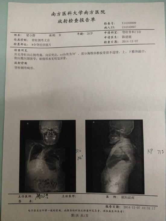 放射检查报告单。