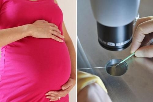 英国一妇女拟用已逝女儿的冰冻卵子代孕产孙。