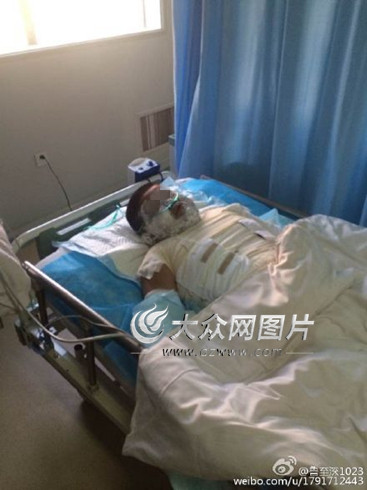 菏泽一9岁男孩被当街浇汽油点燃,上身严重烧伤。(图片来源网络)