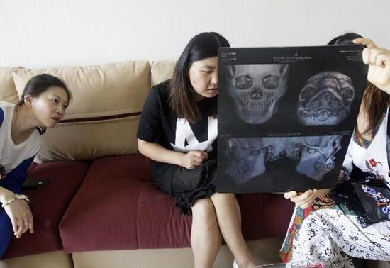大四女生颜值低被嘲讽 瞒家人整形怕死在手术台