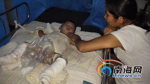 烫伤、溺水及意外事故频发 家有儿童该如何看