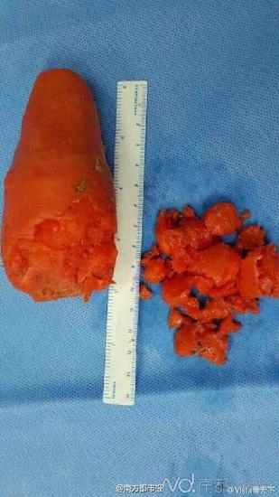 囧哥:<em>妹子</em>地铁<em>搭讪帅哥</em>屡遭拒