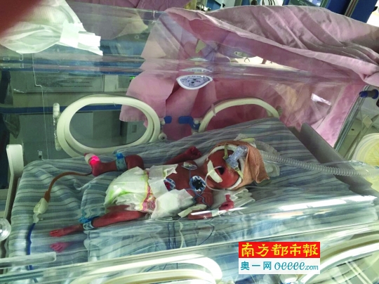双胞胎中的哥哥。