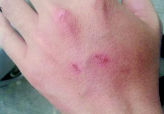 温州一女司机撞车后辱骂警察并连咬两口 被查