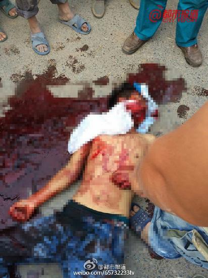 焦作武陟王伊村一男子被當街割喉