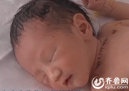 在保温箱内的弃婴，脖子到腋下的缝针清晰可见（视频截图）