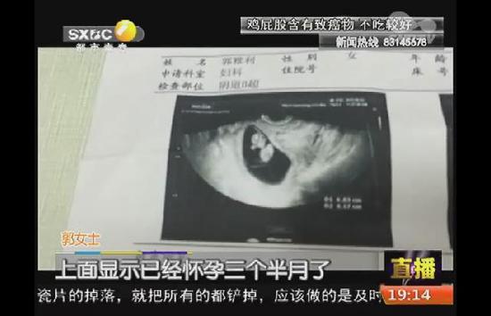 女子怀孕三月 老中医把脉多次称月经不调