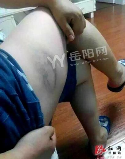 岳阳宝马与公交车“亲吻”,女车主喊人暴打公交司机。