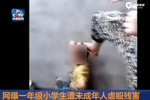 網(wǎng)曝小學(xué)生遭高年級(jí)同學(xué)虐打 衣內(nèi)扔煙頭