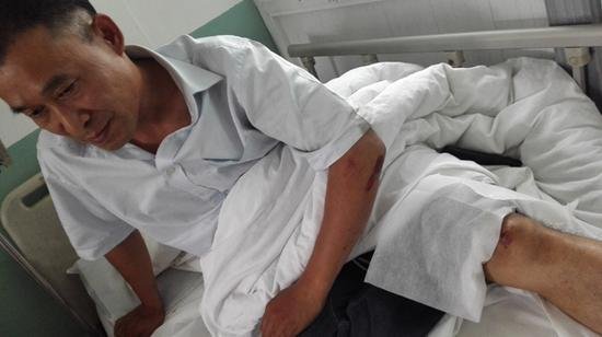 被打傷入院的執(zhí)法人員