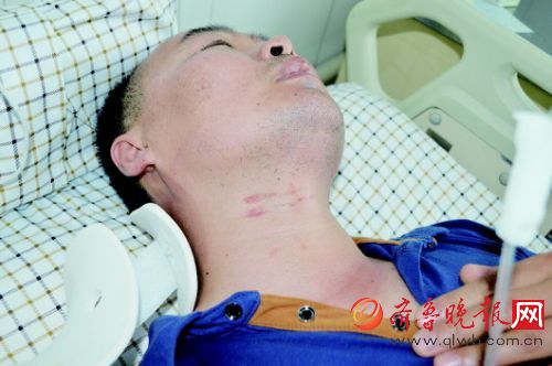 陈军颈部有两道明显的抓痕。记者 路伟摄